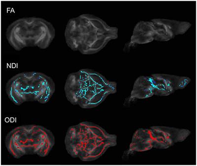 18F-SynVesT-1 PET/MR Imaging of the Effect of Gut Microbiota on Synaptic Density and Neurite Microstructure: A Preclinical Pilot Study